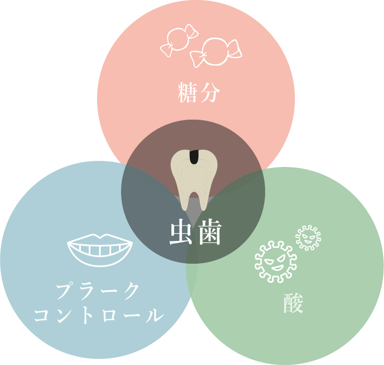 虫歯ができる原因