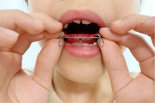 定期的なチェック