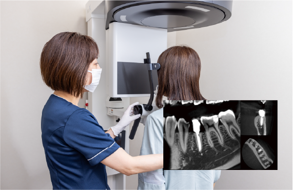 歯科用CT