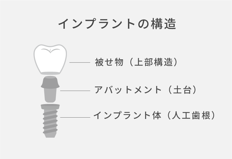 インプラント治療とは