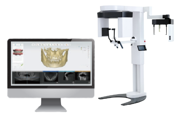 インプラント治療の事前準備