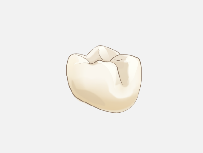 CAD/CAM冠（保険適用）