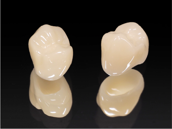 セラミック治療