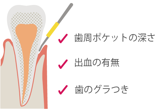 歯周病検査
