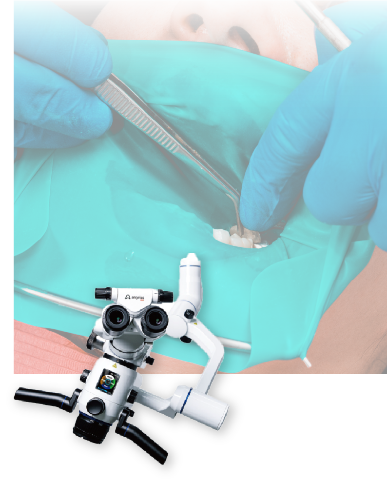 精密根管治療（マイクロスコープ活用）