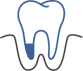 外科的歯内療法