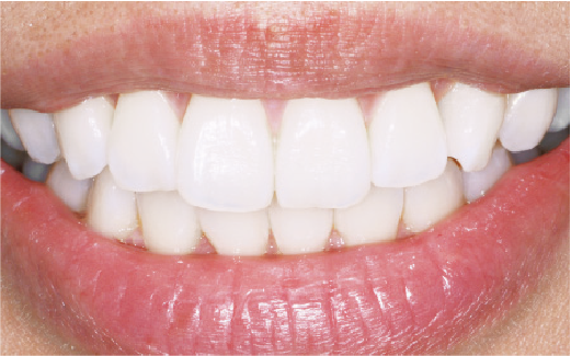 定期的なチェック